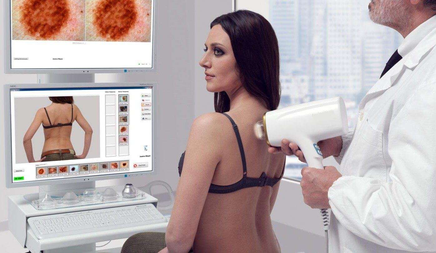 videodermatoscopio