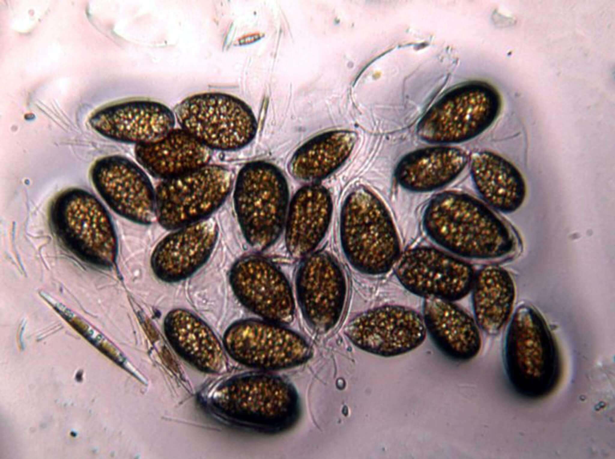 Ostreopsis ovata