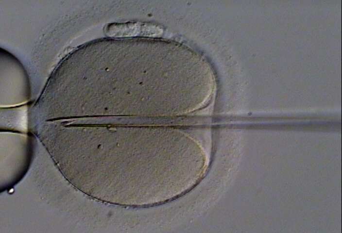 icsi-procreazione-assistita