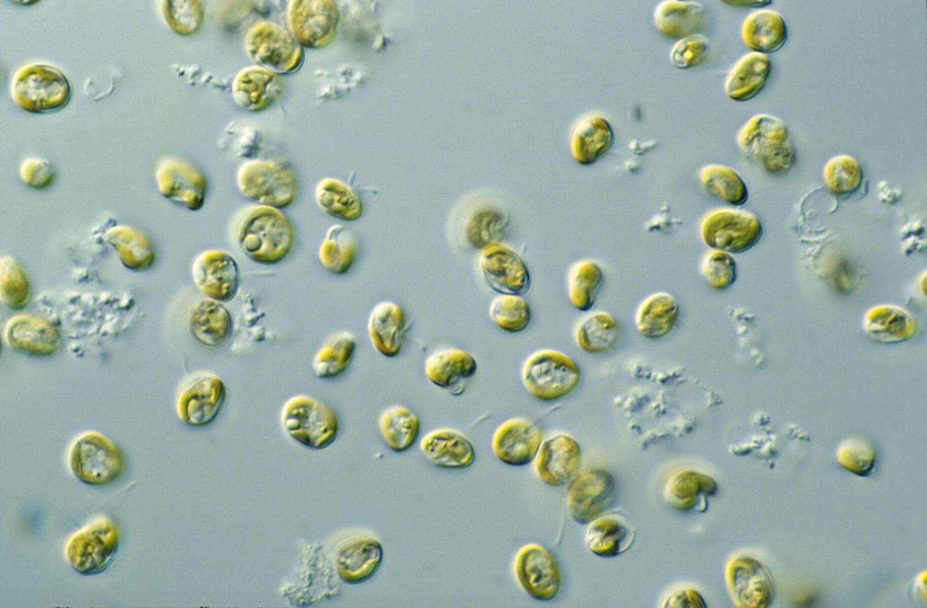 CSIRO_ScienceImage_7604_Microalgae