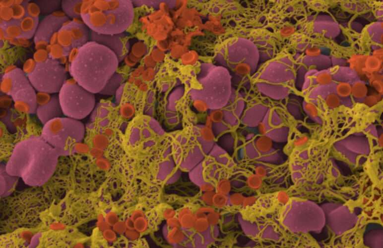 ACS_nano_IIT_Galliera_ictus nanonavicelle