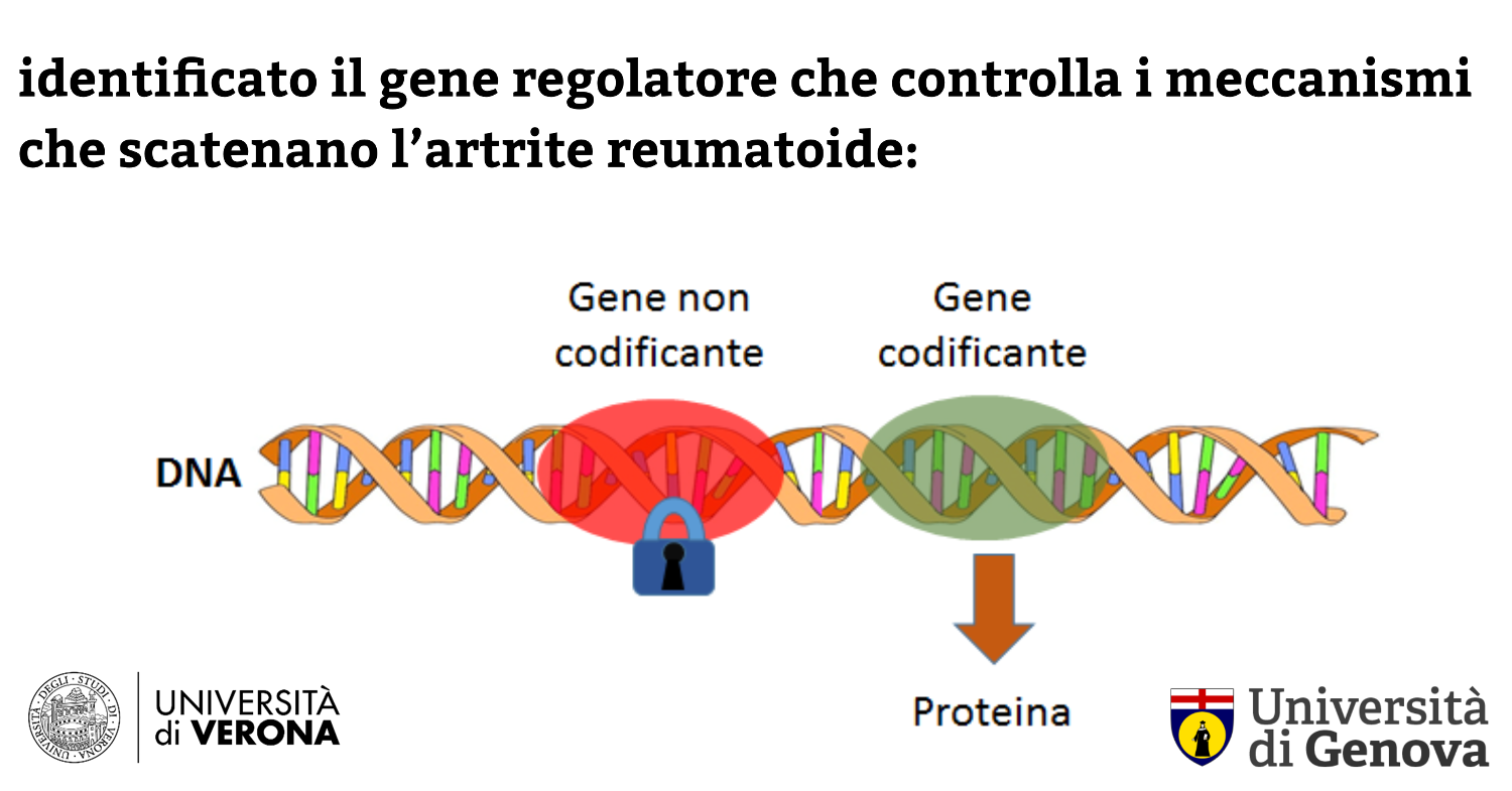 gene identificato artrite UniGe UniVr