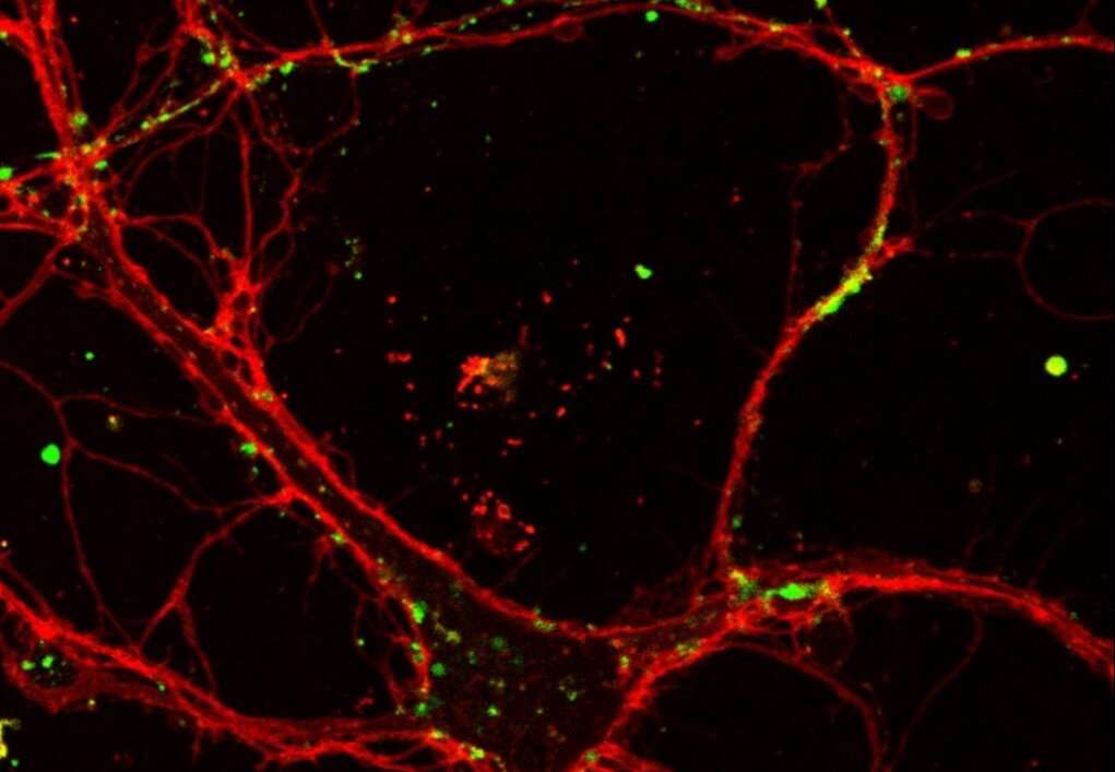 Neurone