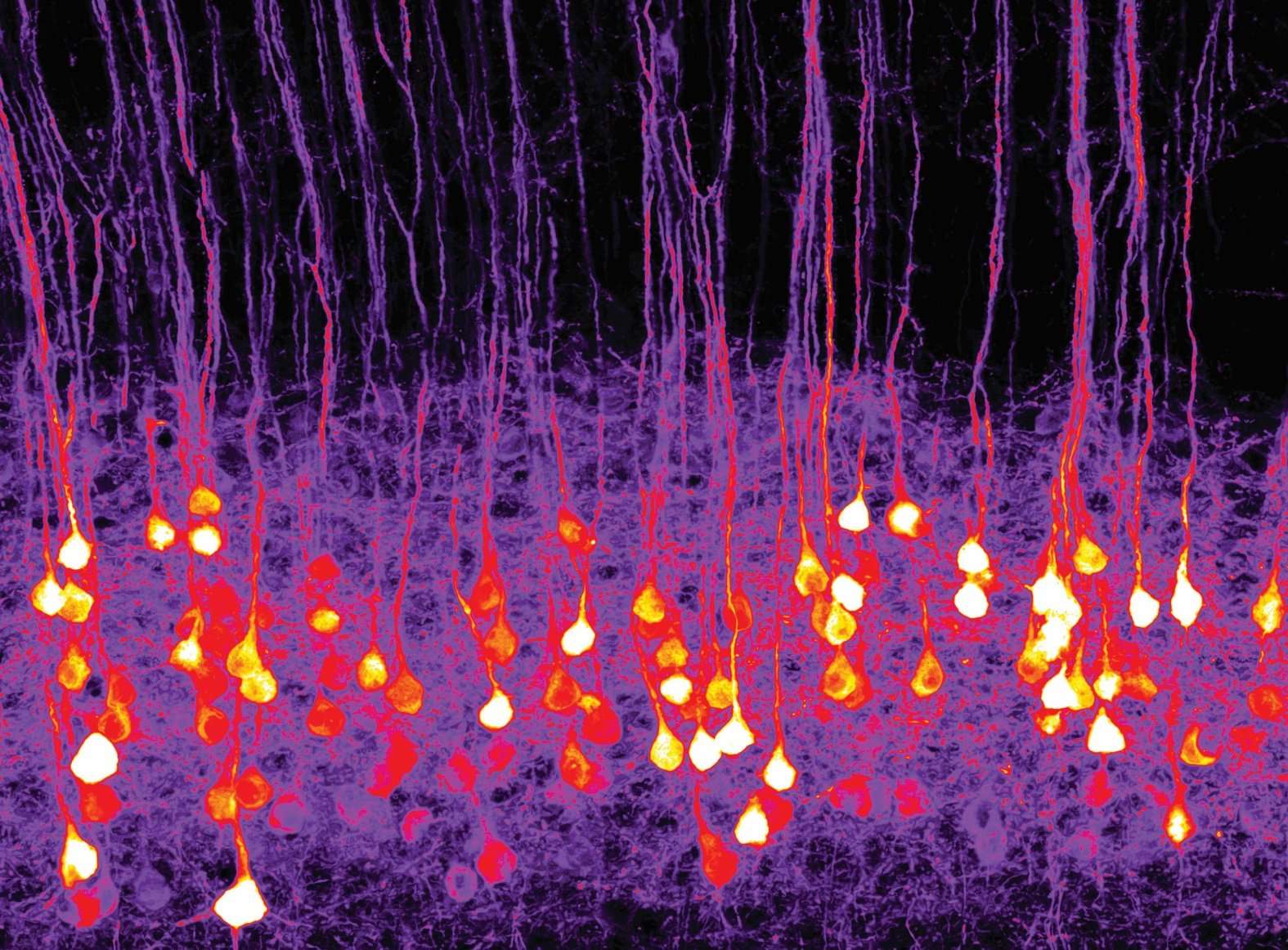 cervello Neuroni optogen – Credits Riccardo Beltramo IIT_2