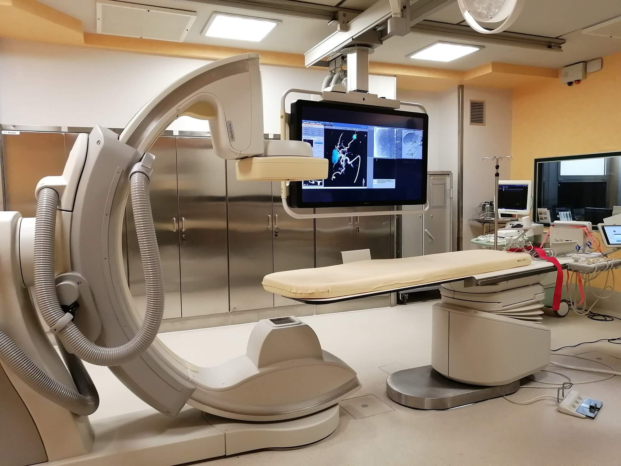 Nuovo angiografo 1