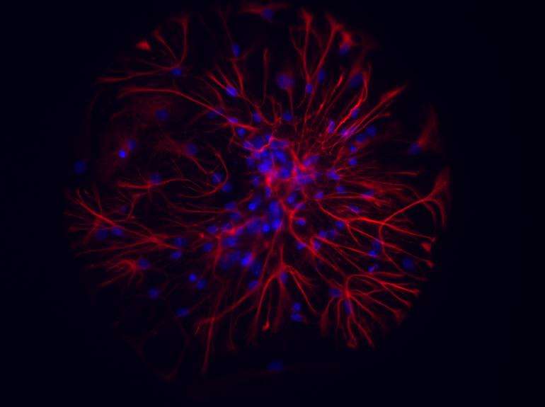 neuroni e astrociti colorati al microscopio ottico a fluorescenza