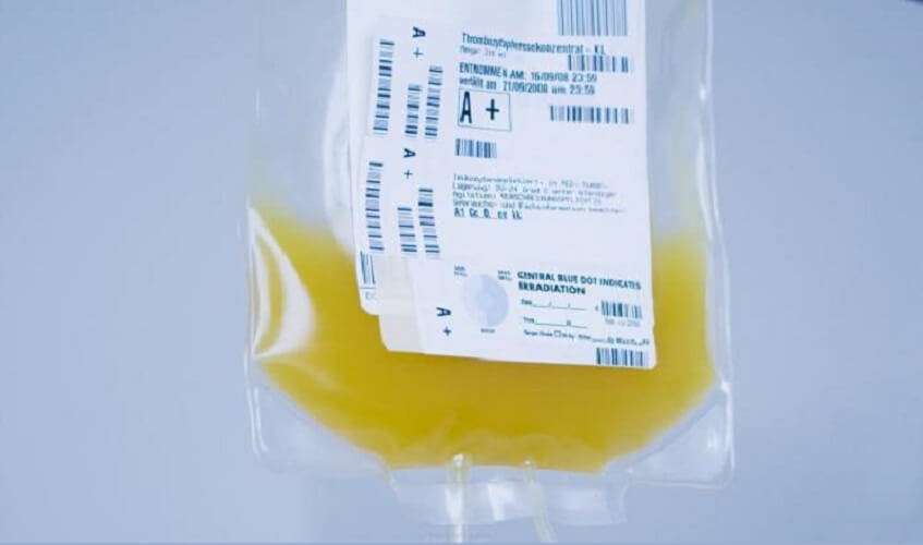 plasma iperimmune coronavirus covid