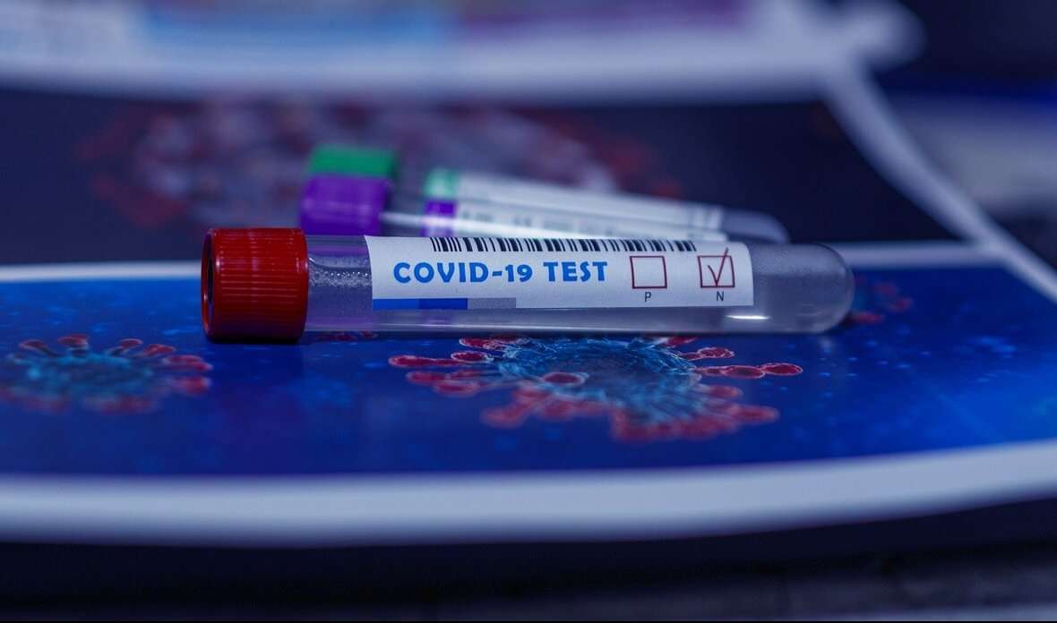 covid coronavirus tampone test tamponi