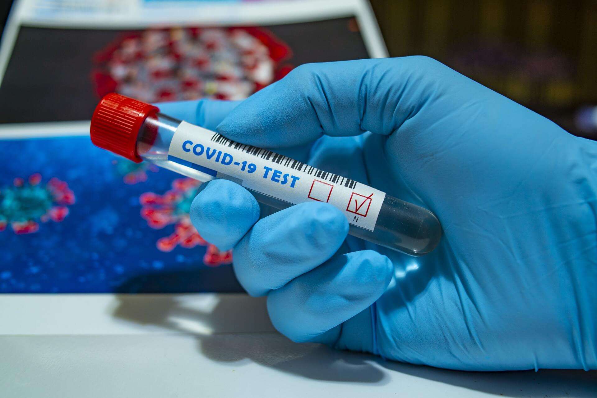 covid coronavirus tampone test tamponi