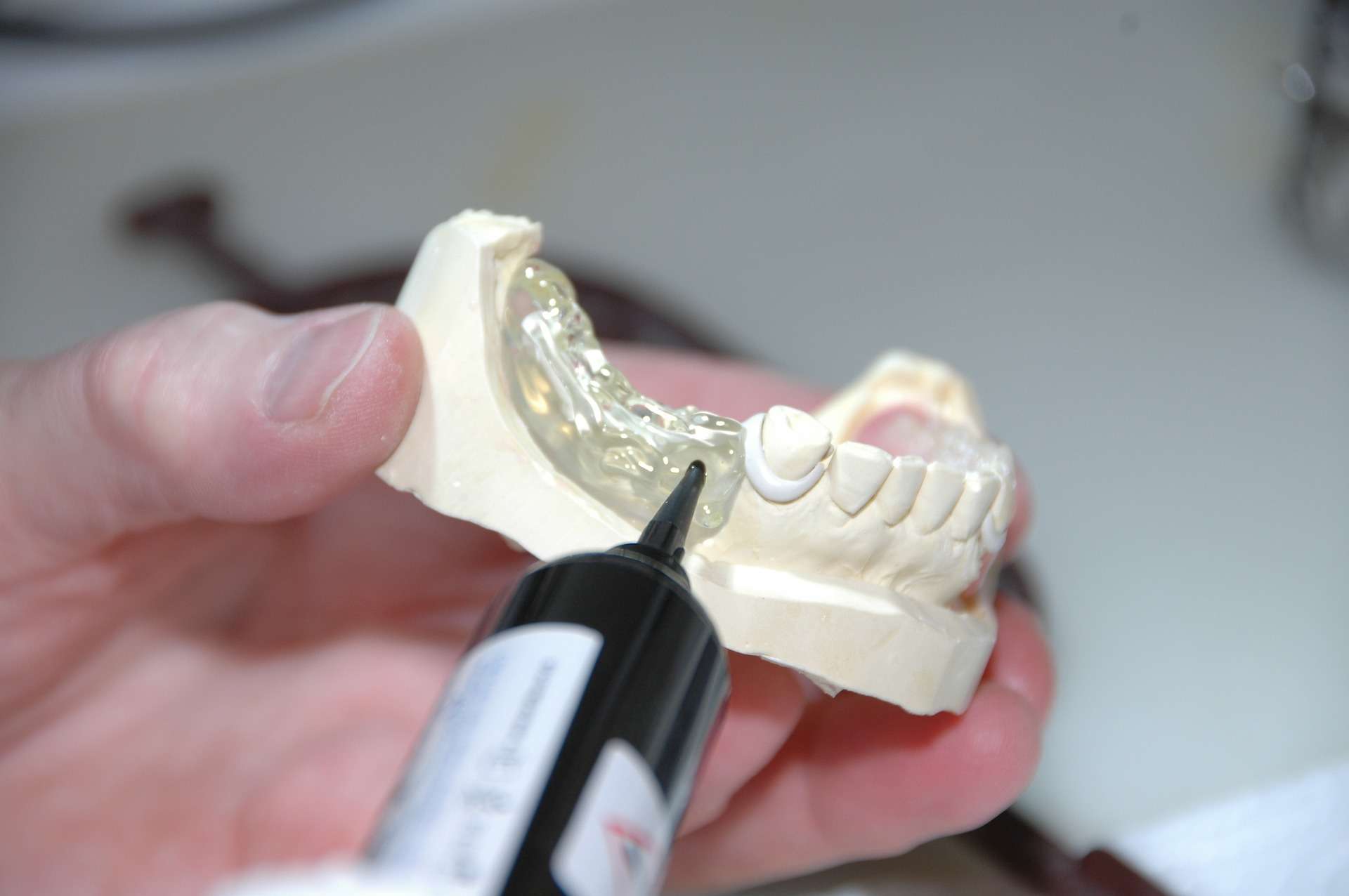 protesi, odontotecnico