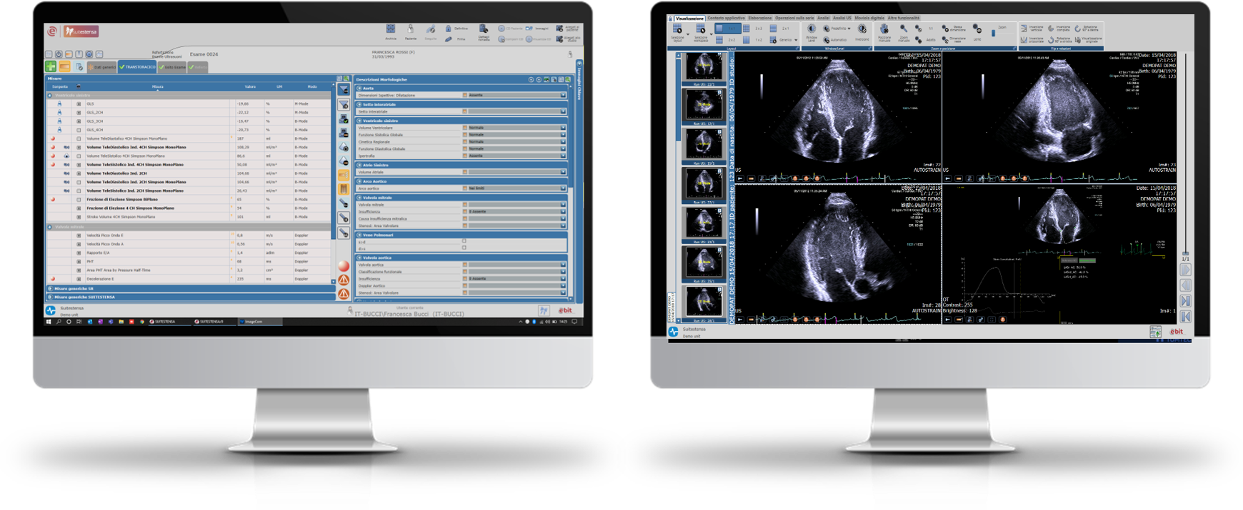 EBIT_Workstation di refertazione cardiologica