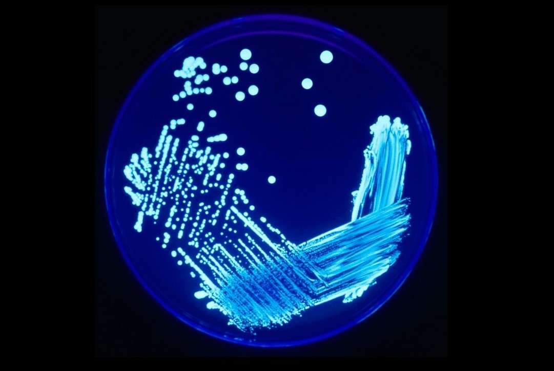 legionella_12_aprile_cna